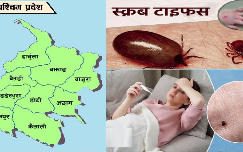 सुदूरपश्चिमका पहाडी जिल्लामा स्क्रब टाइफसको प्रकोप बढ्दै